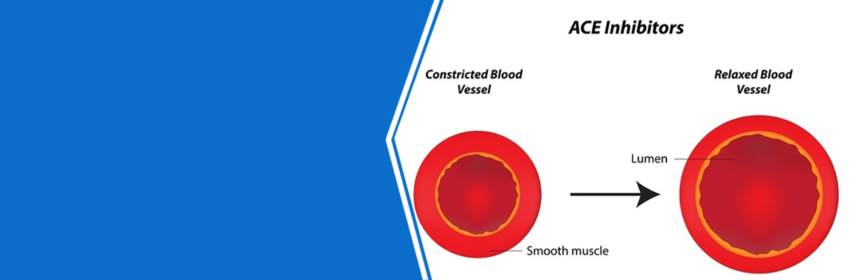 What is the alternative if the patient cannot tolerate ace inhibitors?