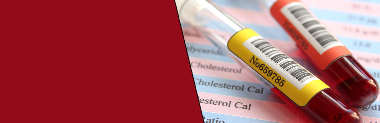 What is the HDL test?