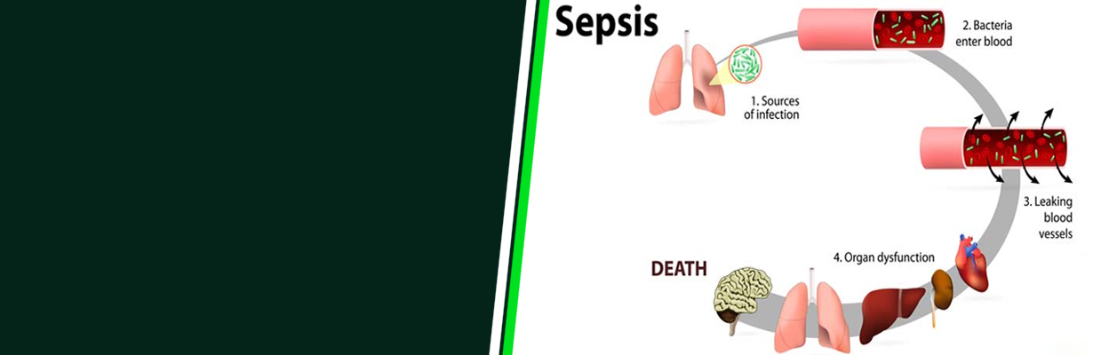 What is the definition of sepsis?