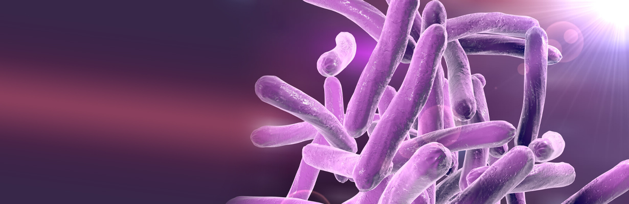What is the diagnosis of Mycobacterium tuberculosis?
