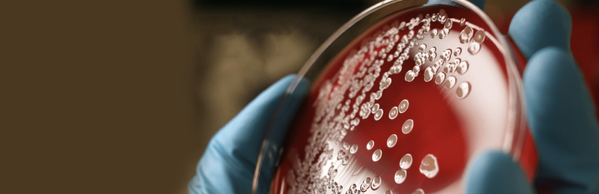 What is the need for sepsis code?