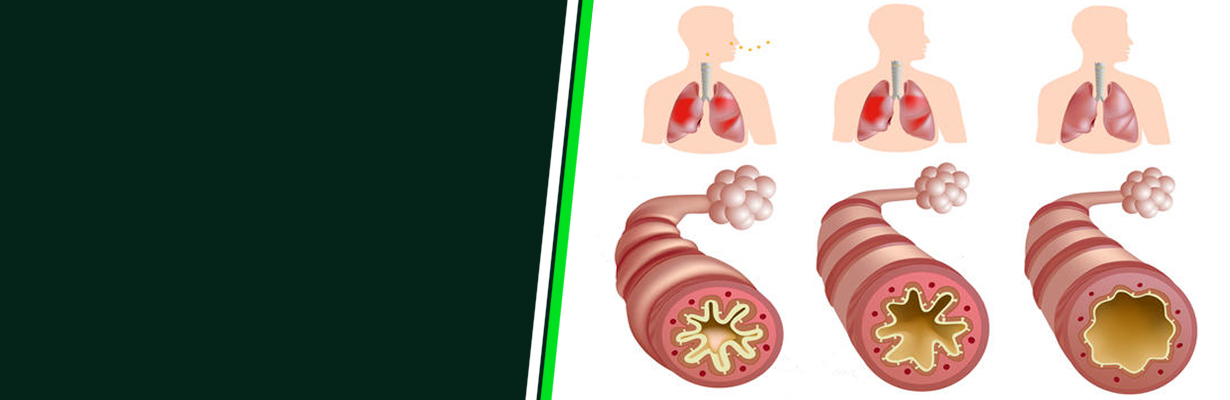 What management of status asthmaticus?