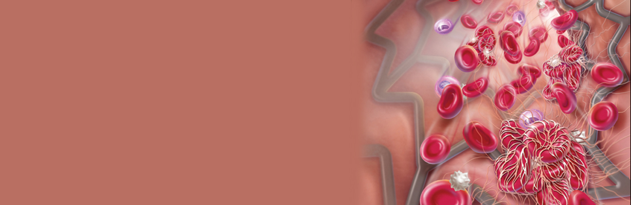 What should be the duration of dual antiplatelet therapy?