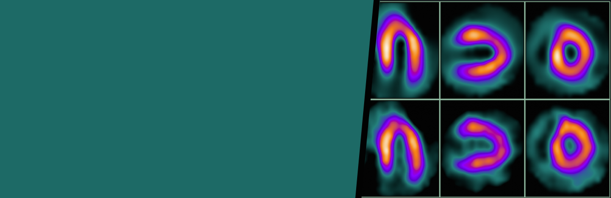What are various important points to be assessed in myocardial perfusion scintigraphy?