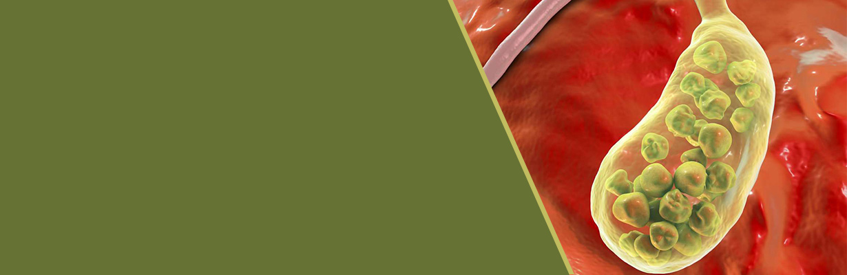 What can happen if gallstones are left untreated?