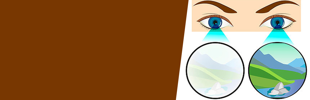 What is Amblyopia or Lazy Eye?
