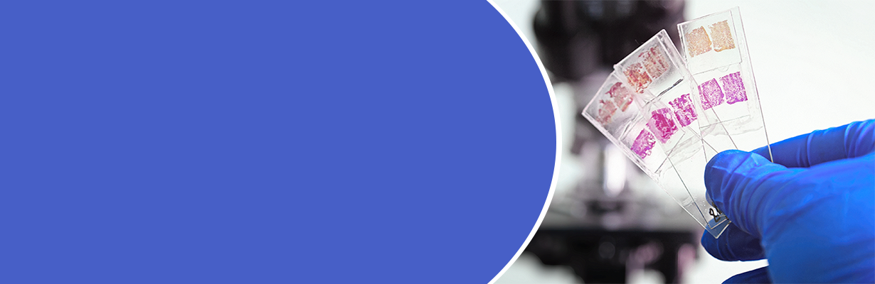 What is false positive & false negative results?
