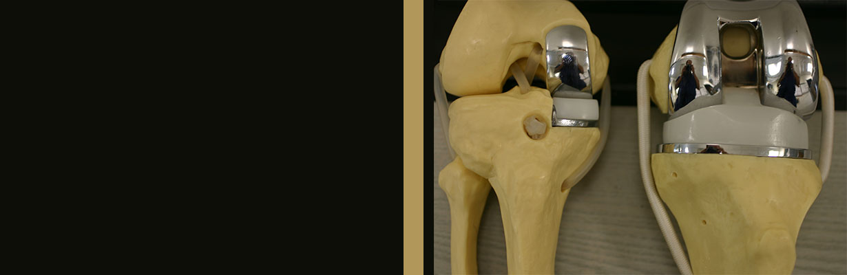 What is partial knee replacement?