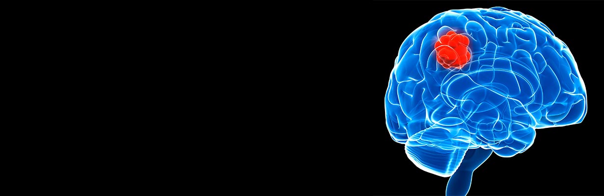 What treatment options are available for patients facing a brain tumor recurrence?
