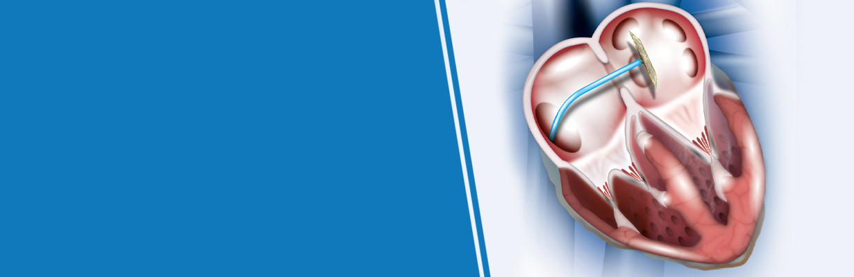 When should ASD closure be done?