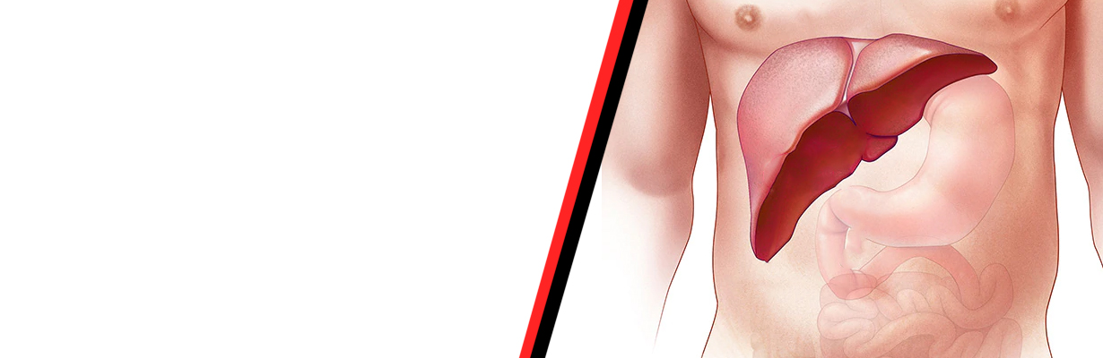 When does Wilsons disease manifest?