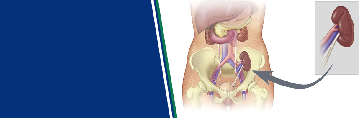 When should we send the patient for kidney transplant?