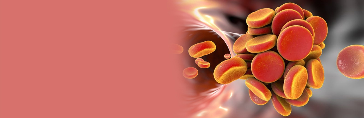 When should we use IV antiplatelet in acute MI?