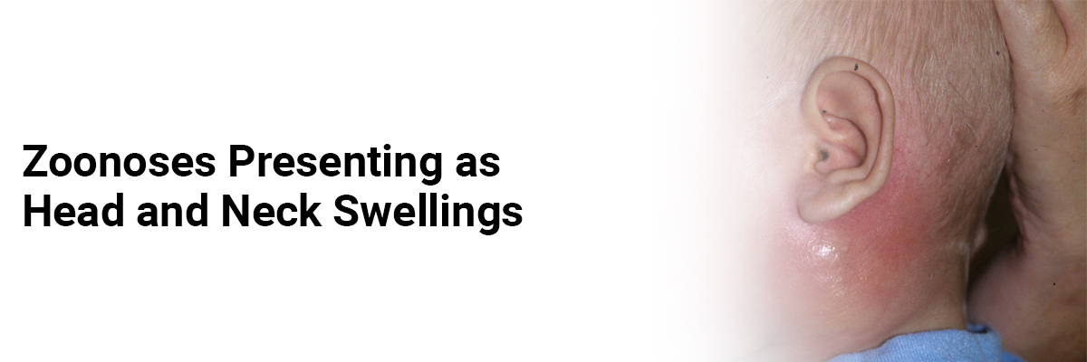 Zoonoses Presenting as Head and Neck Swellings