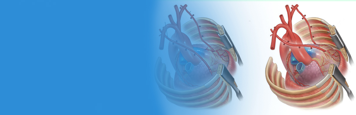 When should we go in for a total arterial bypass surgery?