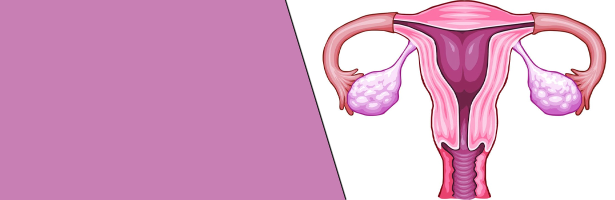 What are the basic investigations of PCOS?
