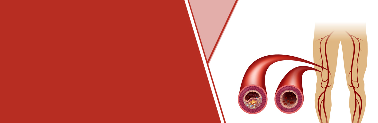 Can bypass be done along with peripheral artery intervention?