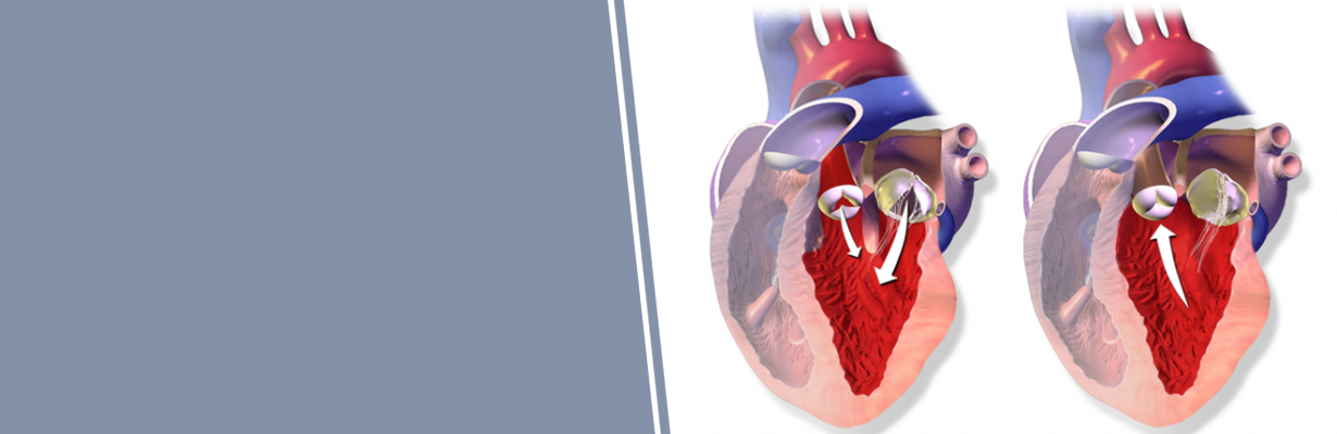 What are the guidelines for intervention in a case with aortic regurgitation?