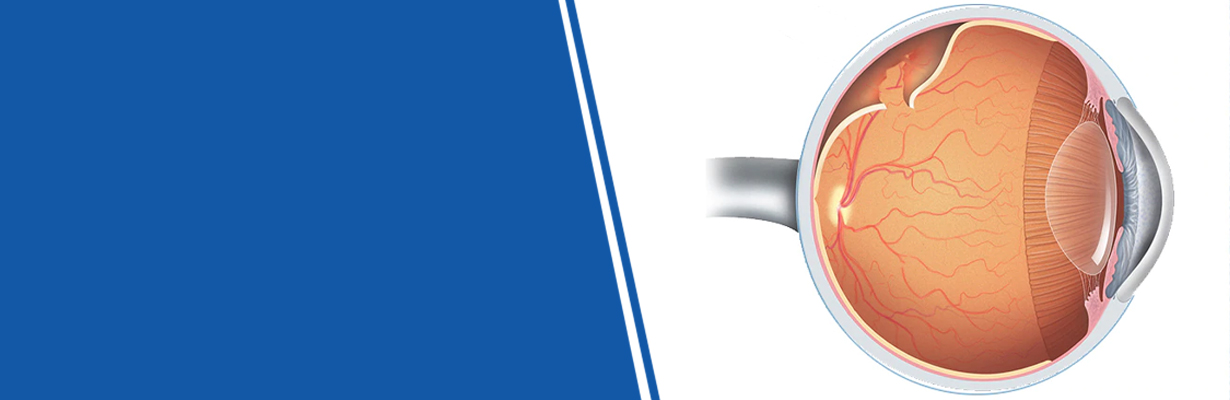 What are the common diseases that have an impact on the retina?
