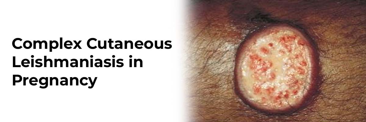 Complex Cutaneous Leishmaniasis in Pregnancy