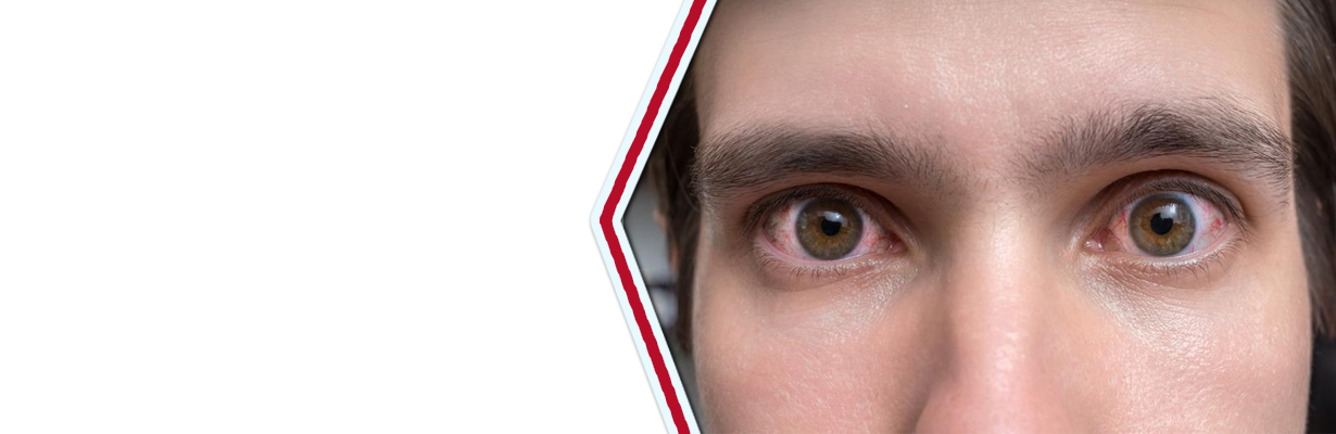 What are the common retinal diseases?
