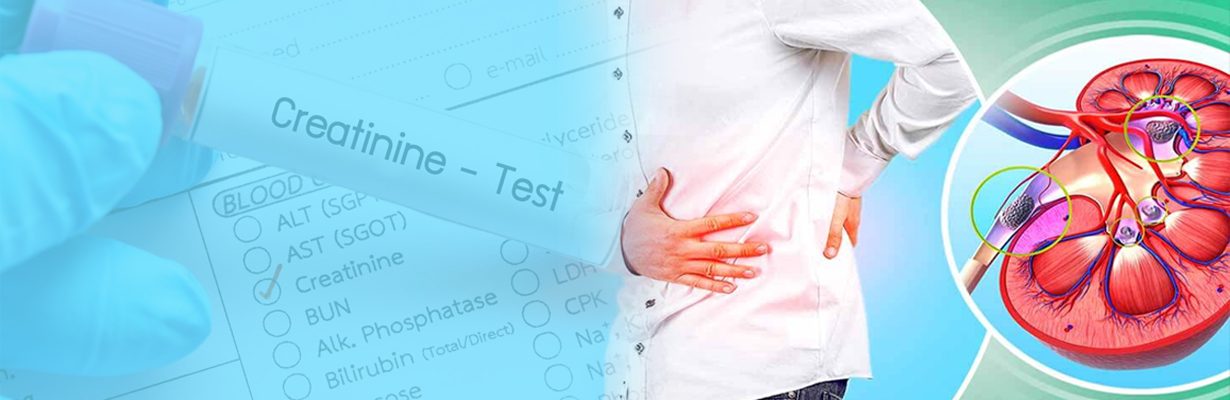 How reliable is creatinine test?