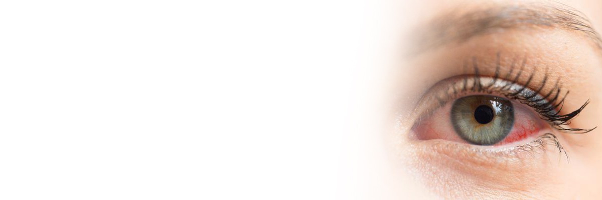 Dry eyes - Symptoms, Causes and Treatment | Medtalks
