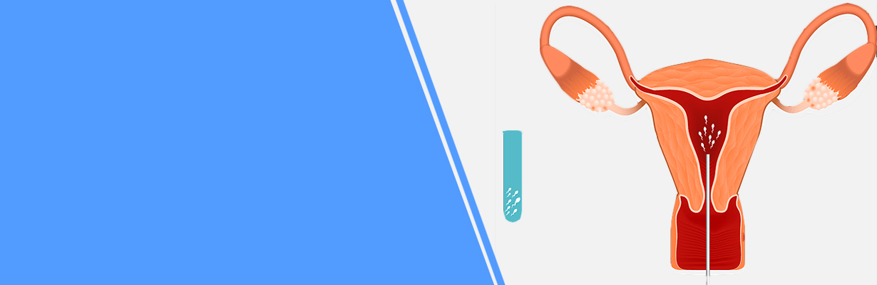 All about emotional support during infertility evaluation?