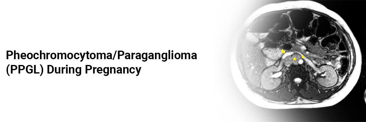 Pheochromocytoma/Paraganglioma (PPGL) during Pregnancy
