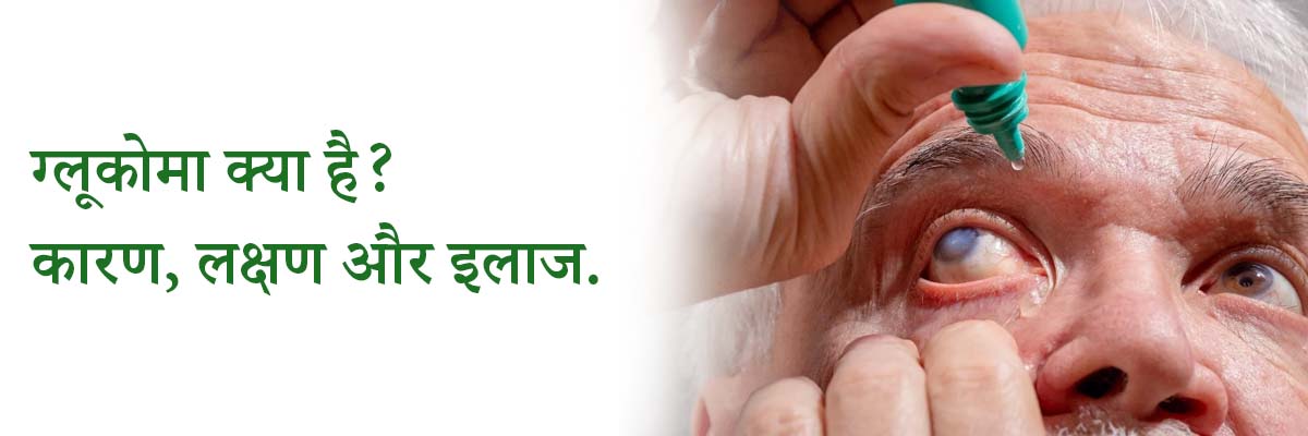 ग्लूकोमा क्या है? कारण, लक्षण और इलाज