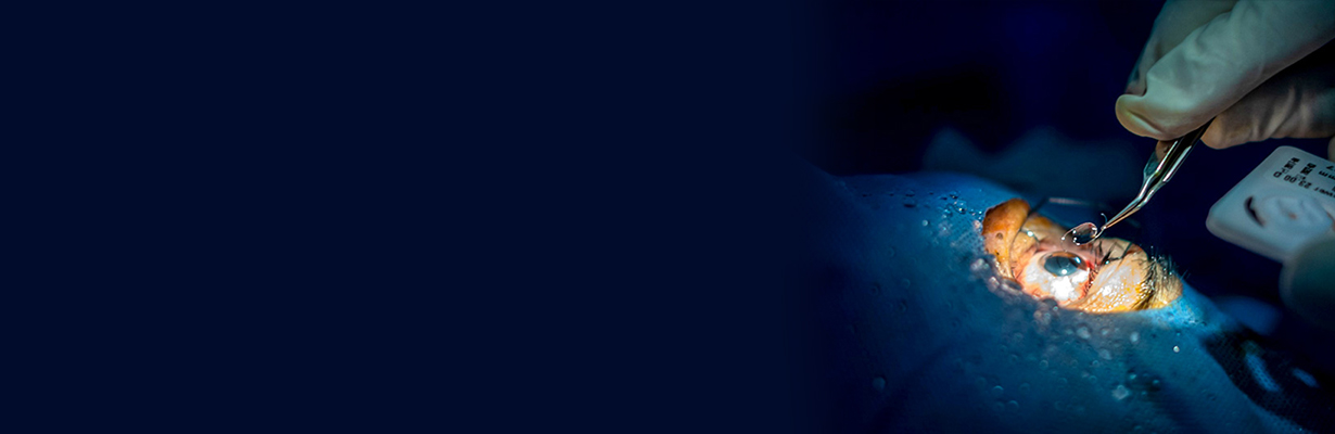 How should we manage glaucoma surgically and what are the indications of surgery?