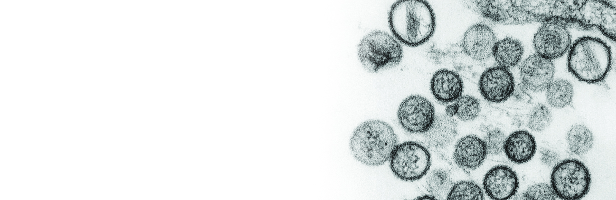 क्या है हंता वायरस, कैसे फैलता है और क्या है इसके लक्षण ?