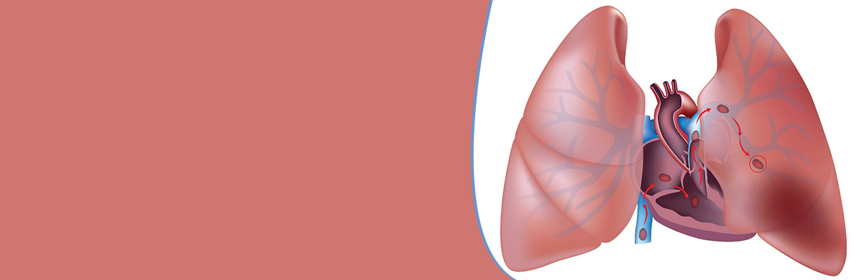 How is pulmonary embolism diagnosed?