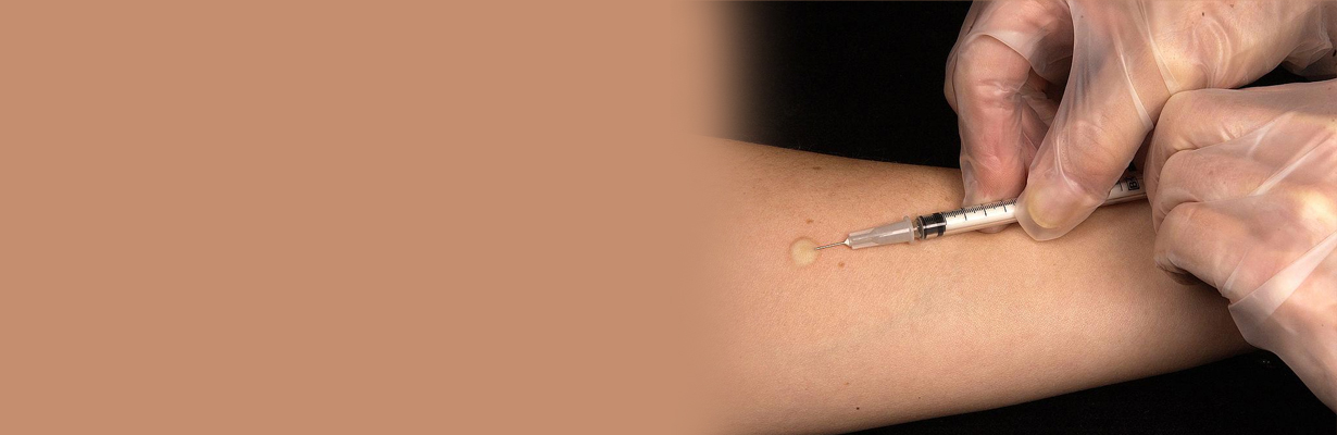 What is  an Intradermal Injection Procedure?