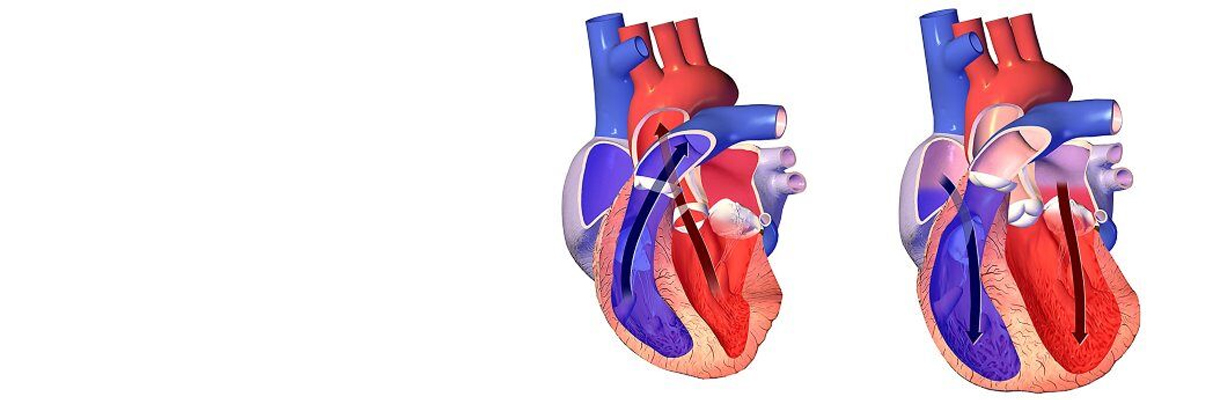 How can we differentiate Diastolic Dysfunction & Diastolic Failure?