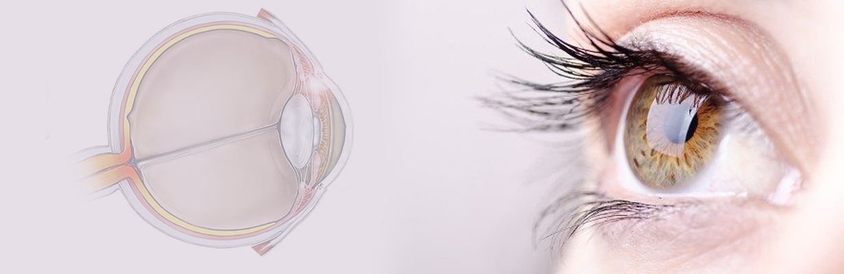 How should we treat glaucoma?