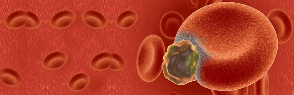 What are the important points to be considered in sepsis and septic shock?
