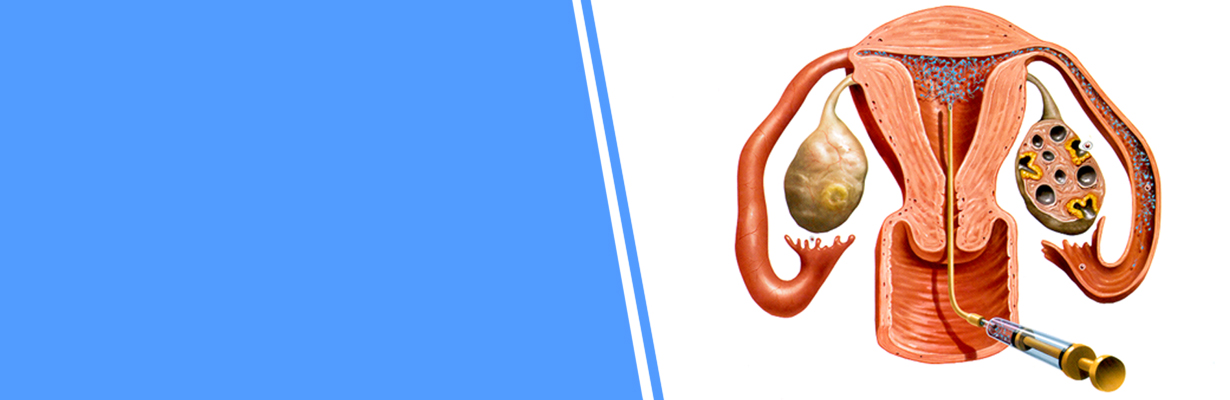 How do we induce ovulation?