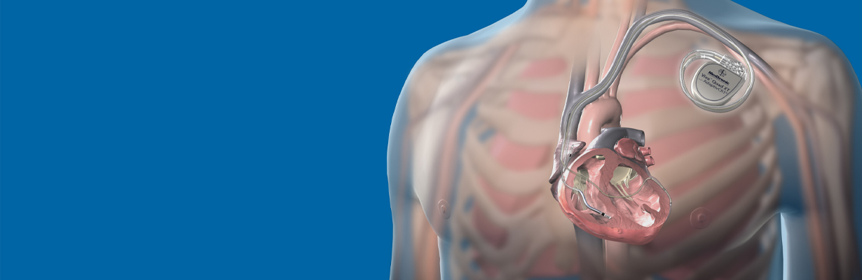 What is the difference between one lead, two lead and three lead pacemakers?
