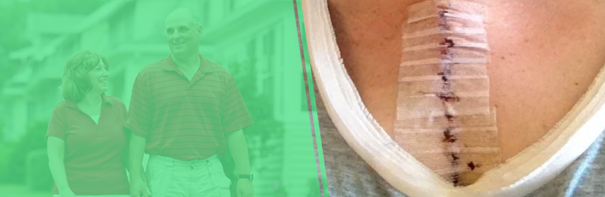 After bypass, when can a person enjoy his married life?