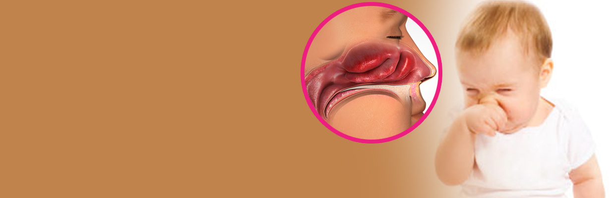 Nasal congestion and mouth breathing. What could it mean?