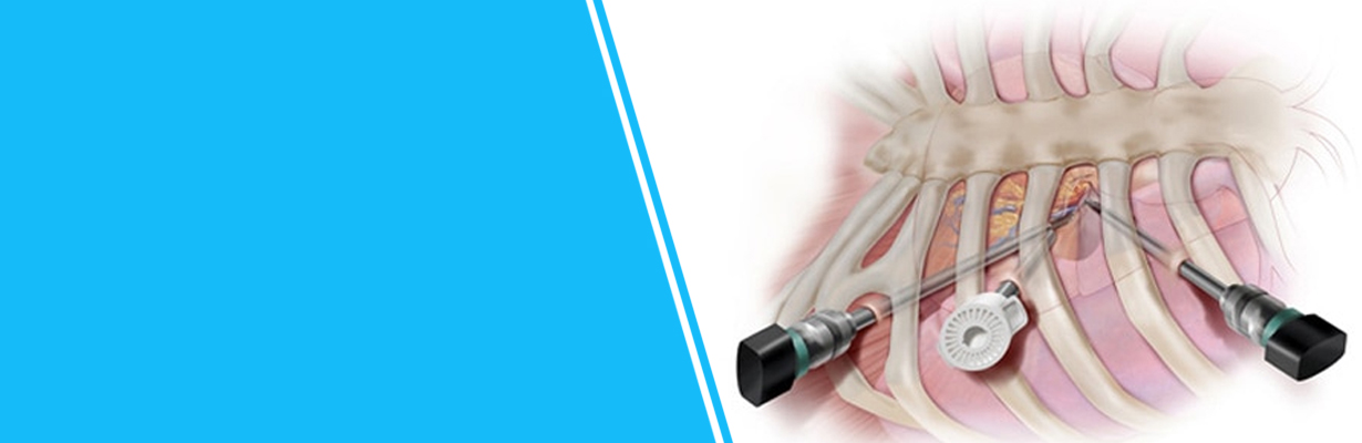 What is Minimal Invasive Heart Bypass Surgery treatment?
