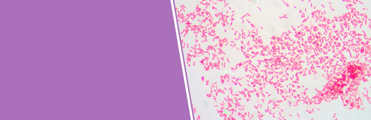What are the common Gram-negative organisms showing AMR?