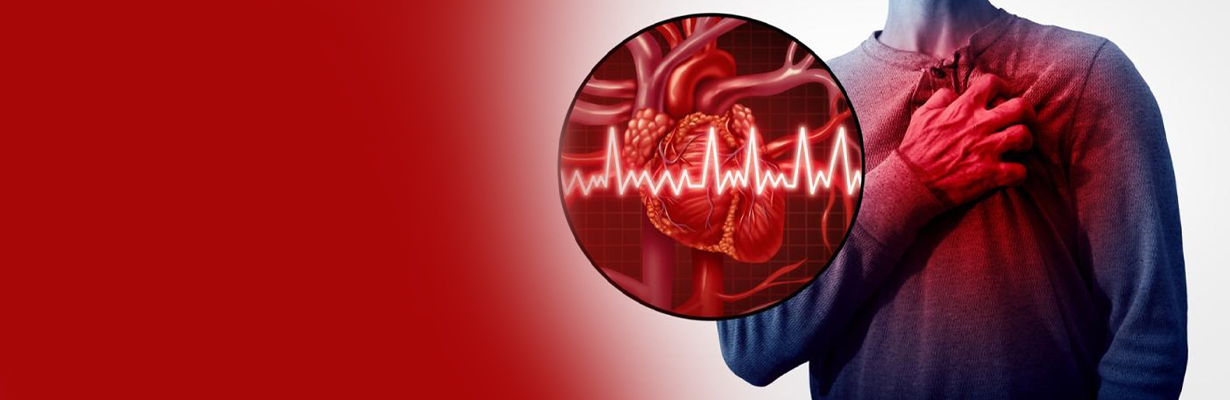 What is the role of ticagrelor in acute MI?