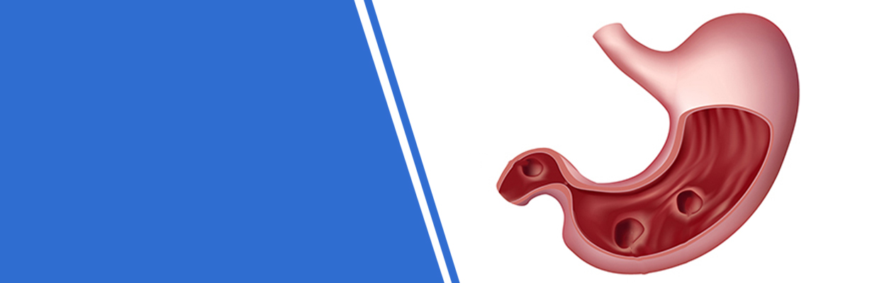 What is the management of peptic ulcer disease?
