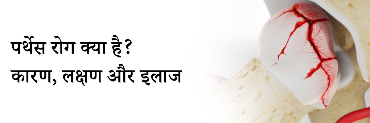 पर्थेस रोग क्या है? कारण, लक्षण और इलाज | Perthes Disease in Hindi