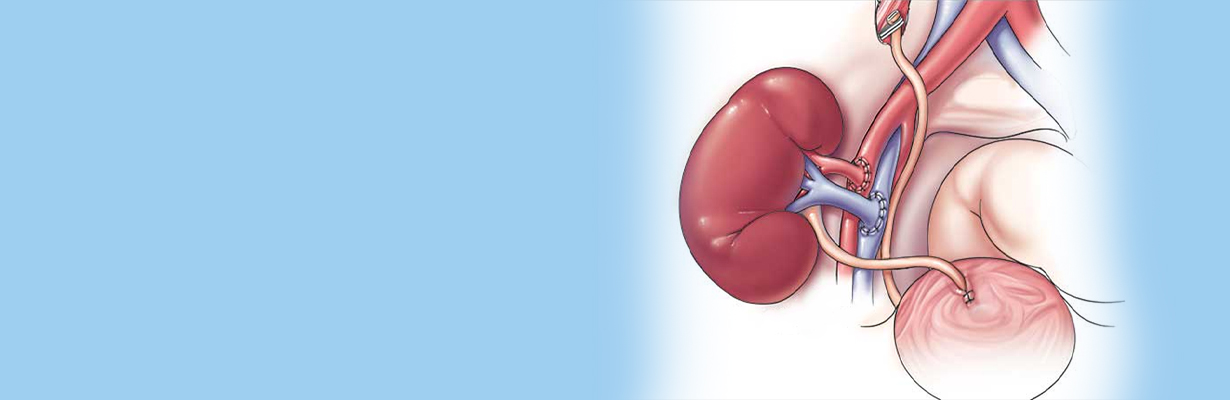 How should we manage CAD in a patient who is going for renal transplant?