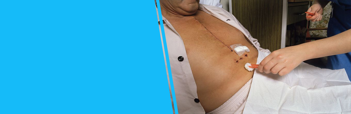 How complicated  is Coronary Heart bypass surgery?