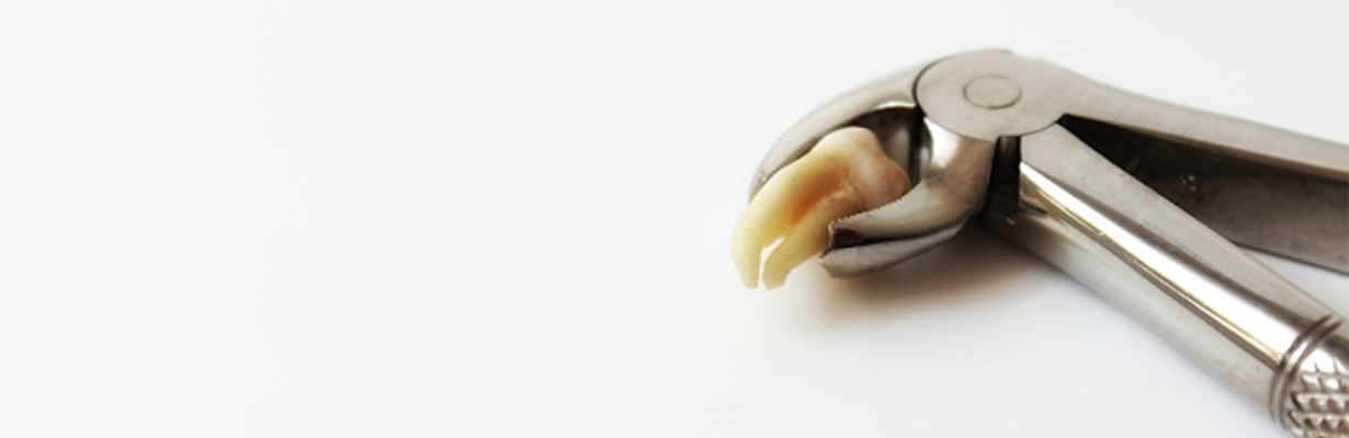 After tooth Removal Care?