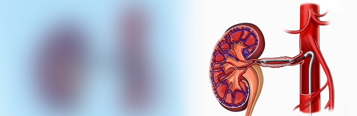 Can primary PCI be done along with renal angioplasty?
